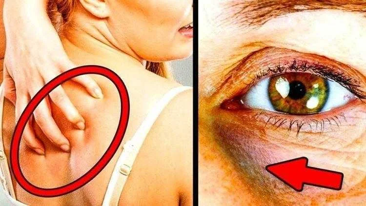 sinais de alerta de que esta comendo muito acucar Sinais de alerta de que está comendo muito açúcar