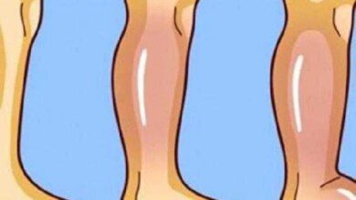 Veja algumas dicas de como dizer adeus á retenção de líquidos