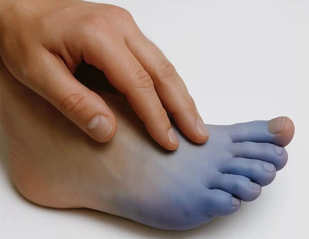 6 motivos pelos quais seus pés estão frios constantemente