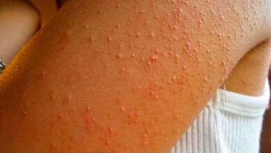 d5895b407057d8c56cb6cbe5bfef9244