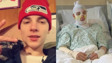 Jovem enfrenta fogo para salvar sobrinha de 8 anos e sofre queimaduras graves: "Não ia deixar ela morrer"