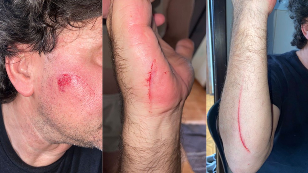 video motorista de aplicativo e atacado com facao por passageiro Vítima teve ferimentos superificiais pelo corpo — Foto: Arquivo pessoal