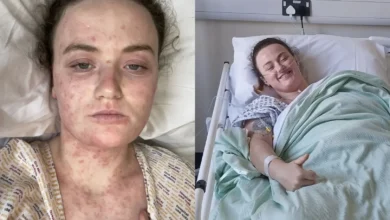 Mulher quase morre após dor nas costas ser ignorada por médicos: "Disseram que eu estava sendo dramática"