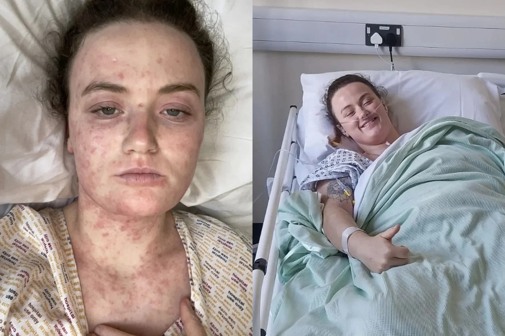 Mulher quase morre após dor nas costas ser ignorada por médicos: "Disseram que eu estava sendo dramática"