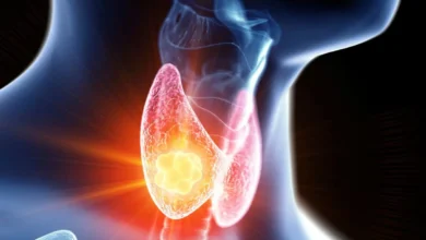 cancer tireoide dr eduardo henrique endocrinologista sao paulo 1920w